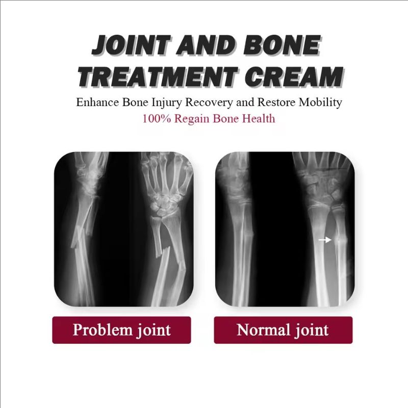 Soothing Joint Bone Soreness, Deformation Correction and Repair, Joint Bone Collagen Cream