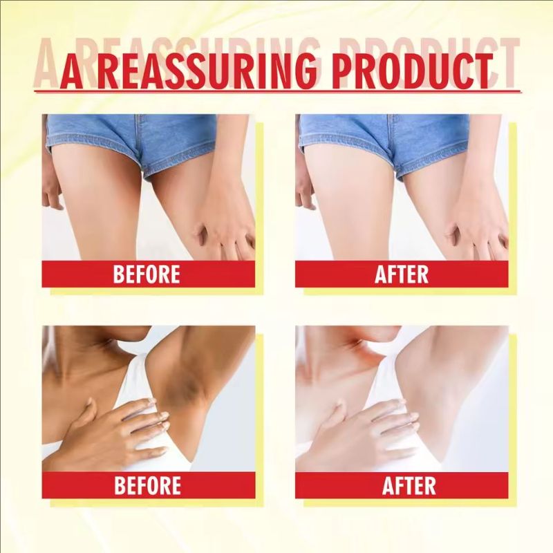 Body Whitening Cream Underarm Elbow Knee Legs Melanin Removal Darkness Lightening Fade Pigment Dark Spots Bleaching Care Cream