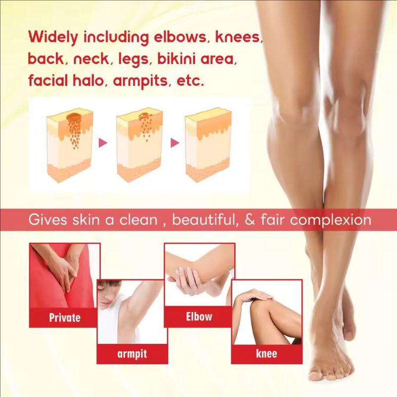 Body Whitening Cream Underarm Elbow Knee Legs Melanin Removal Darkness Lightening Fade Pigment Dark Spots Bleaching Care Cream