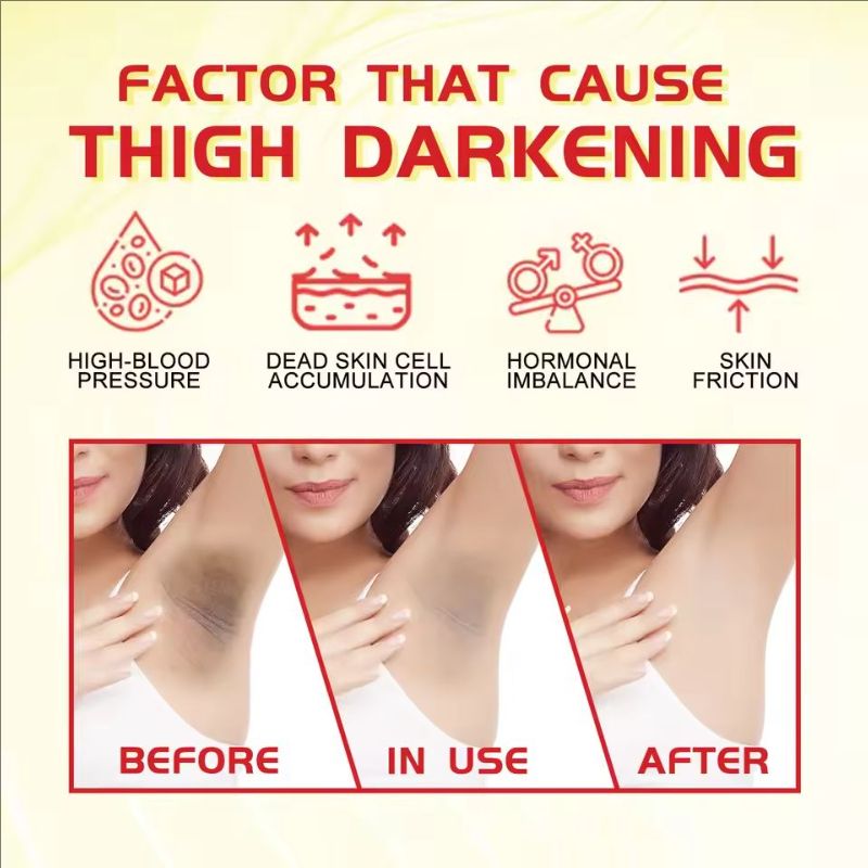 Body Whitening Cream Underarm Elbow Knee Legs Melanin Removal Darkness Lightening Fade Pigment Dark Spots Bleaching Care Cream