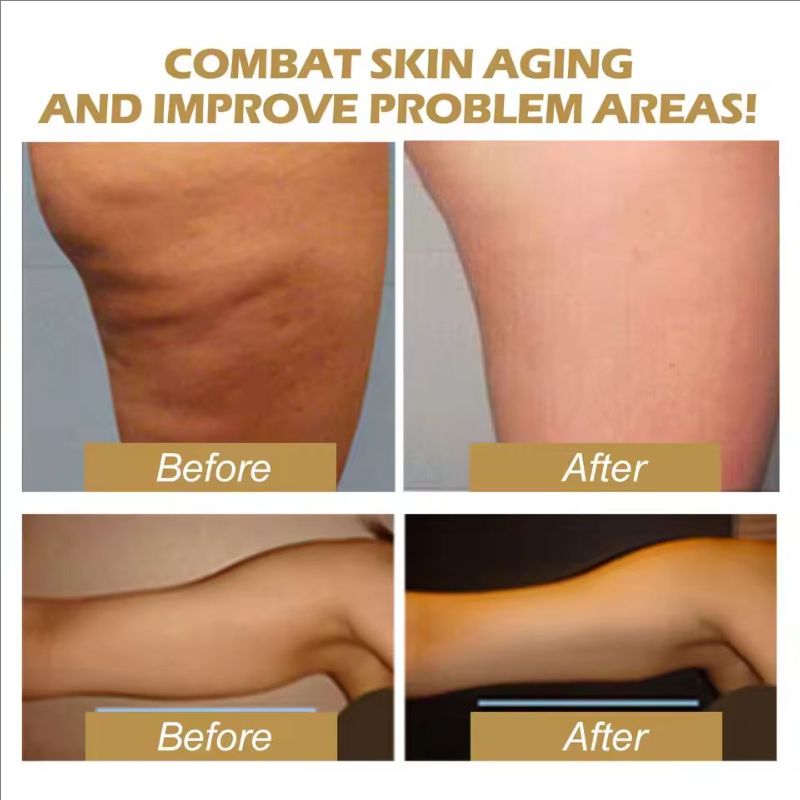 Collagen Slimming Oil Lifting Firming Belly Fat Burner Remove Cellulite Tighten Breast Buttock Weight Loss Shaping Essence Oil