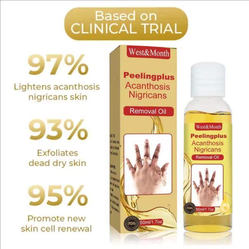 Peeling Oil Bleach Dark Skin Exfoliate Arm Elbow Knee Leg Dead Skin Remove Joint Melanin Dark Knuckles Removal Pigment Corrector