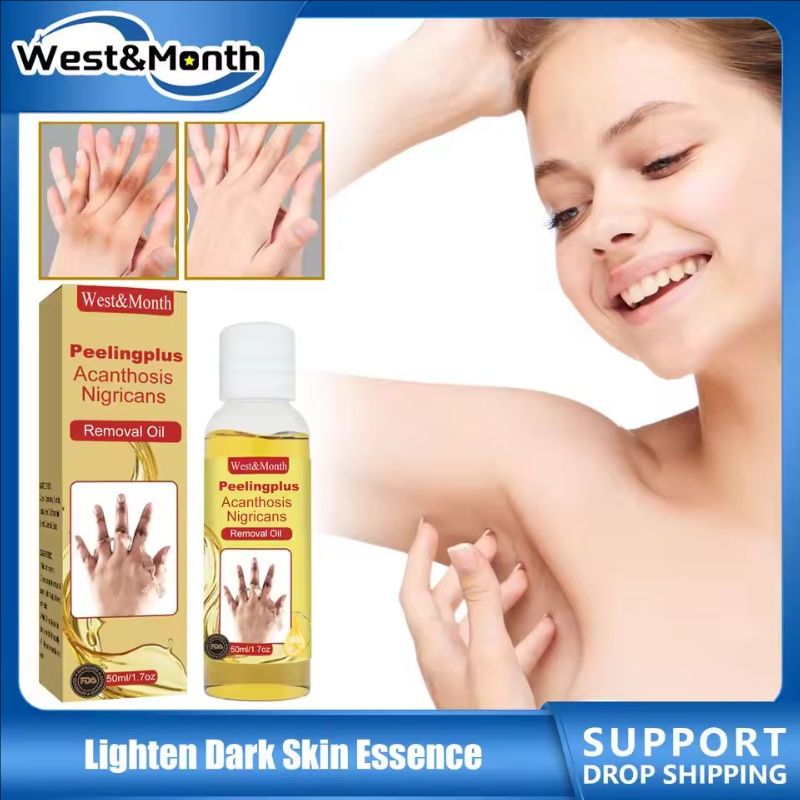 Peeling Oil Bleach Dark Skin Exfoliate Arm Elbow Knee Leg Dead Skin Remove Joint Melanin Dark Knuckles Removal Pigment Corrector