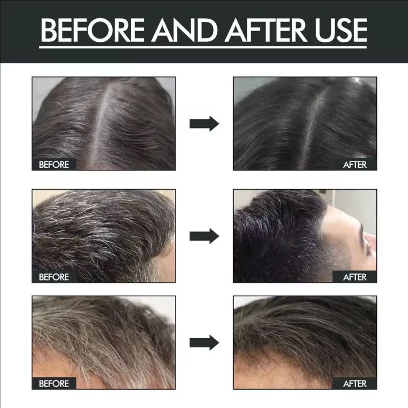 Black Hair Spray Dye White to Black Serum Anti Gray Cover White Hair Remover Spray Scalp Nourishing Darkening Hair Spray