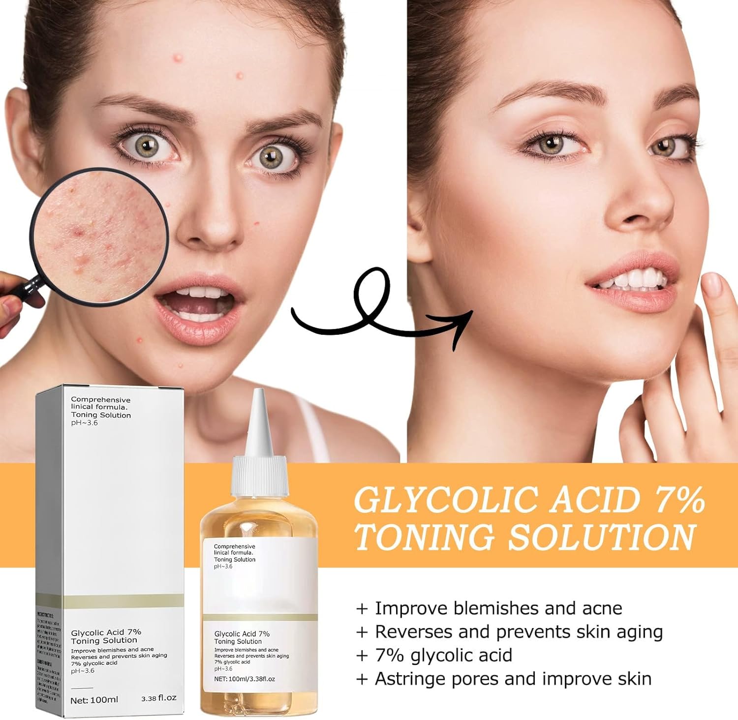 The Ordinary Glycolic Acid 7% Exfoliating Toner | 240ml- Hydrating & Pore Minimizing Solution for Clearer Skin | Gentle Acne Treatment with Aloe Vera & Ginseng Extracts | 240ml