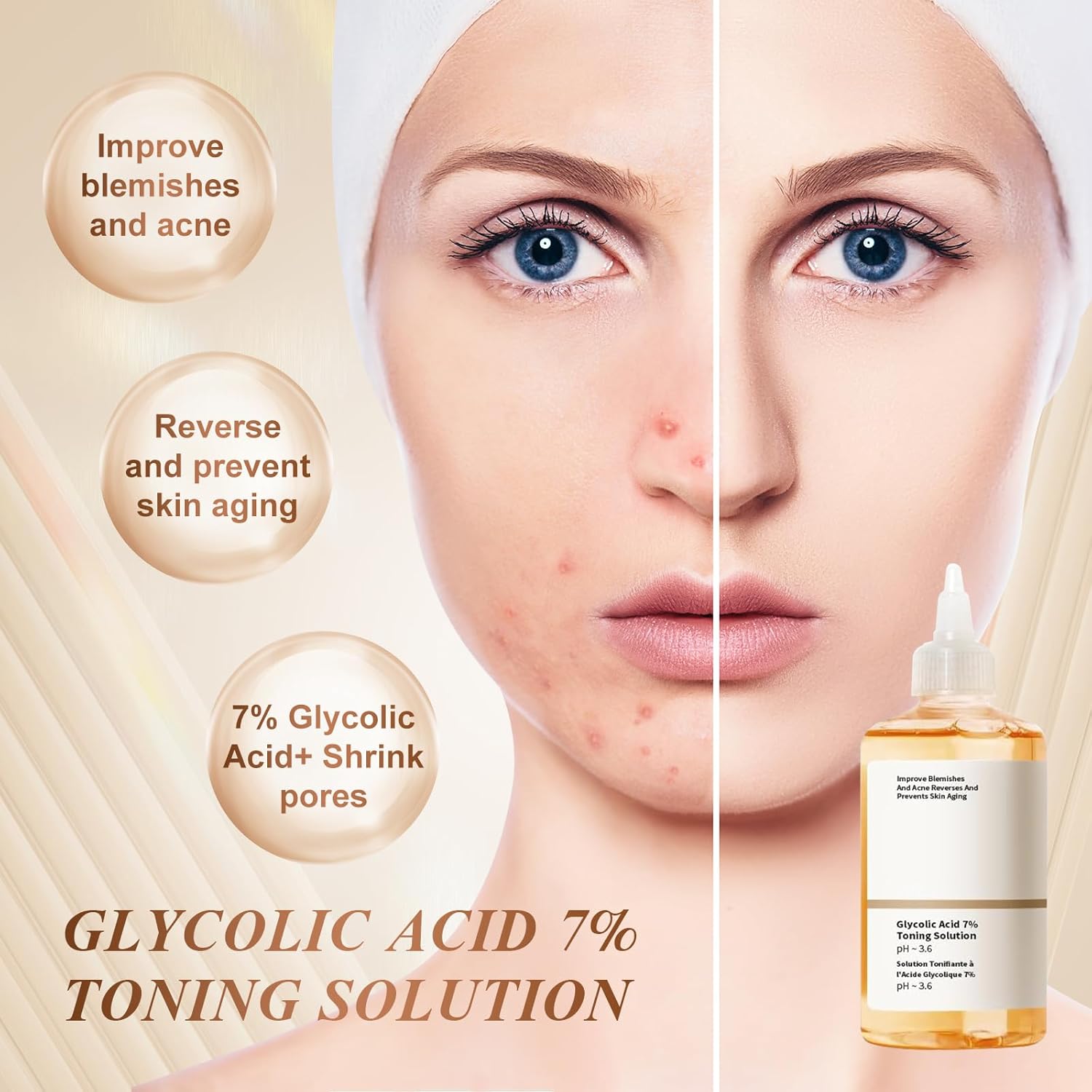 The Ordinary Glycolic Acid 7% Exfoliating Toner | 240ml- Hydrating & Pore Minimizing Solution for Clearer Skin | Gentle Acne Treatment with Aloe Vera & Ginseng Extracts | 240ml