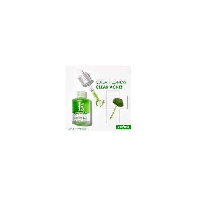 Anua 10+ Azelaic Acid 10 + Hyaluron Serum. Hydrates, Treats & Calms Acne, Rosacea, Soothes Redness & Irritations, Fades Acne Marks, Hyperpigmentations, Spots, Smooths, Soften, Evens Skin Tone & Glows