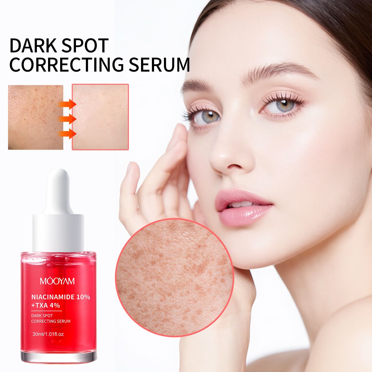 Darks Spots Remover Niacinamide 10% + TXA 4% Serum Melanin Removal Fade Melasma Dark Spots Corrector Shrink Pores Hyaluronic Acid Moisturizing Skin Care Uneven Skin Tone, Texture -MOOYAM-