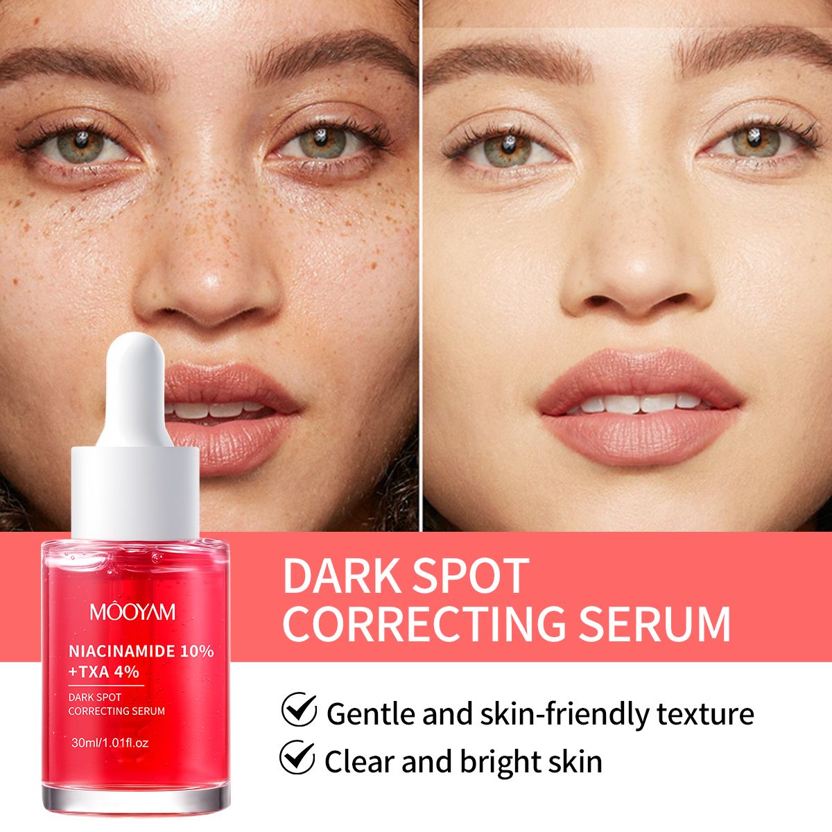Darks Spots Remover Niacinamide 10% + TXA 4% Serum Melanin Removal Fade Melasma Dark Spots Corrector Shrink Pores Hyaluronic Acid Moisturizing Skin Care Uneven Skin Tone, Texture -MOOYAM-