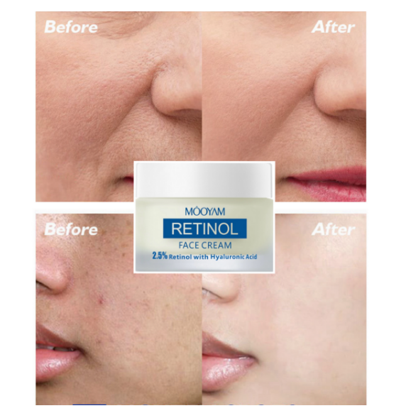 Retinol Face Cream Firming Lifting Anti-Wrinkle Brightening Moisturizing Skin Care Best Face Moisturizer Clear Essence Cream