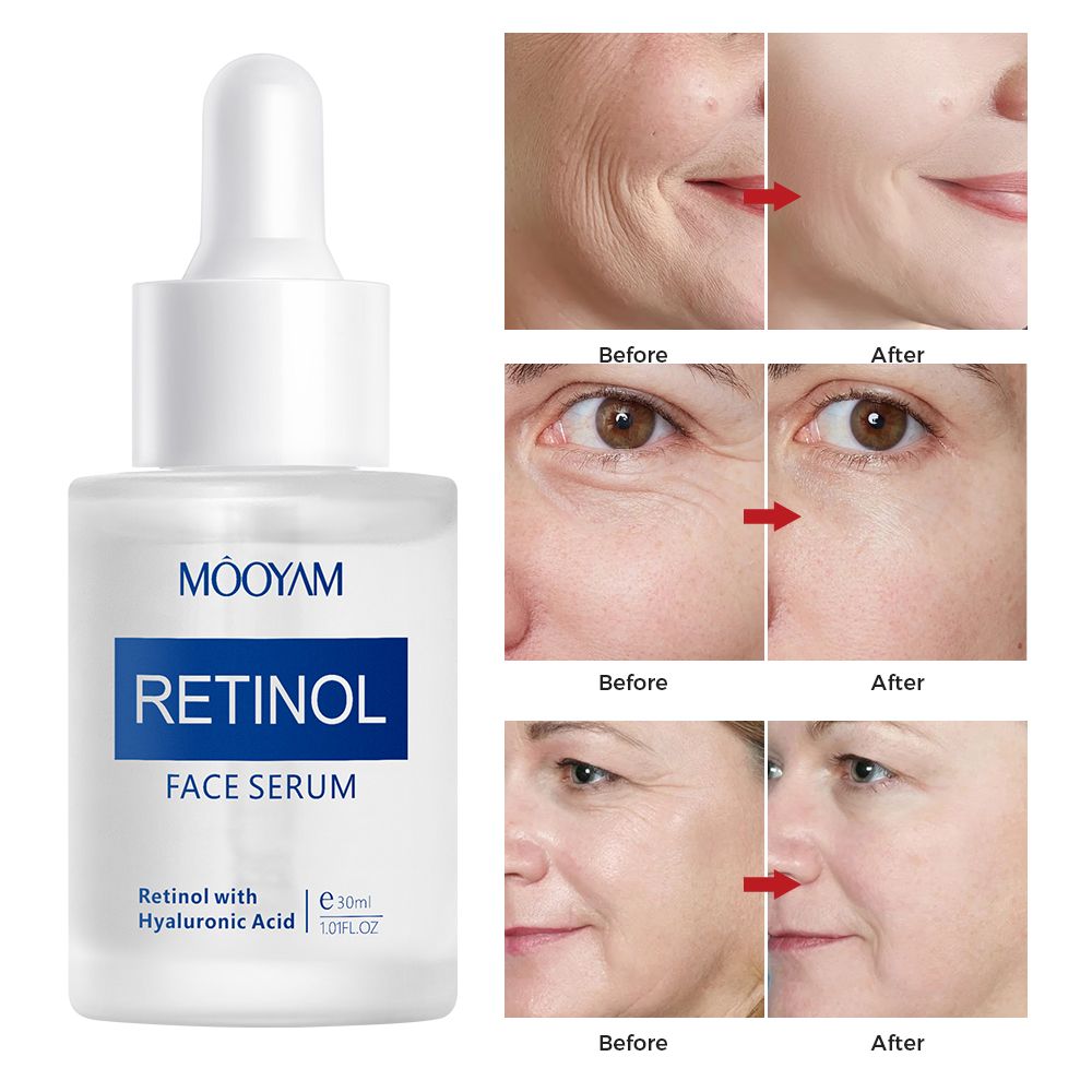 Retinol Face Serum Moisturizing Firming Anti-wrinkle Anti-aging Deep Care Essence Retinol Serum-MOOYAM