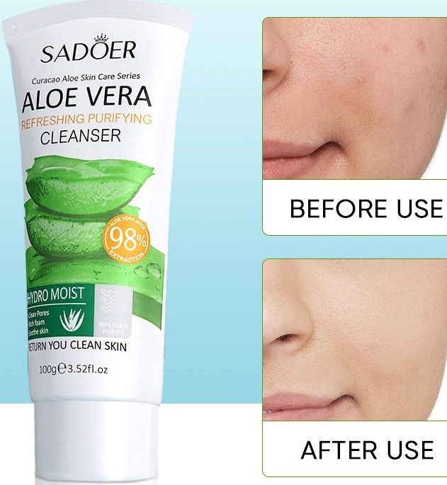 Sadoer Aloe Vera Deep Facial Cleanser rich foam- 100g