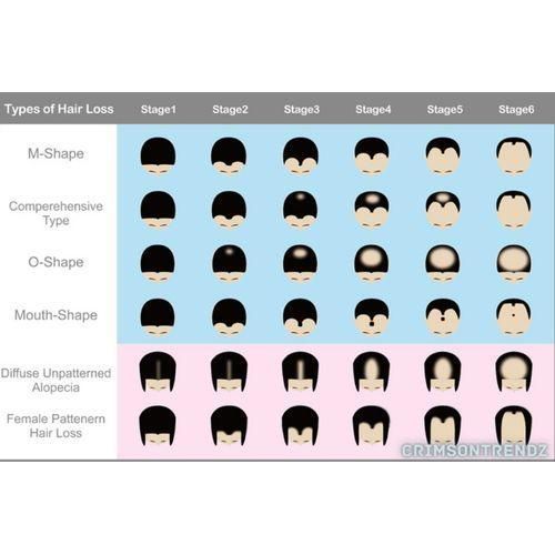 Kirkland Minoxidil 5% extra strength hair loss regrowth system treatment for men Beard care oil premium Topical Solution  bottle of 60ml (1months supply) derma roller