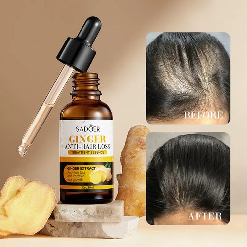 SADOER Ginger Plant Hair Growth Serum + Free DERMA ROLLER Nutrition Hair Care Hair Essence