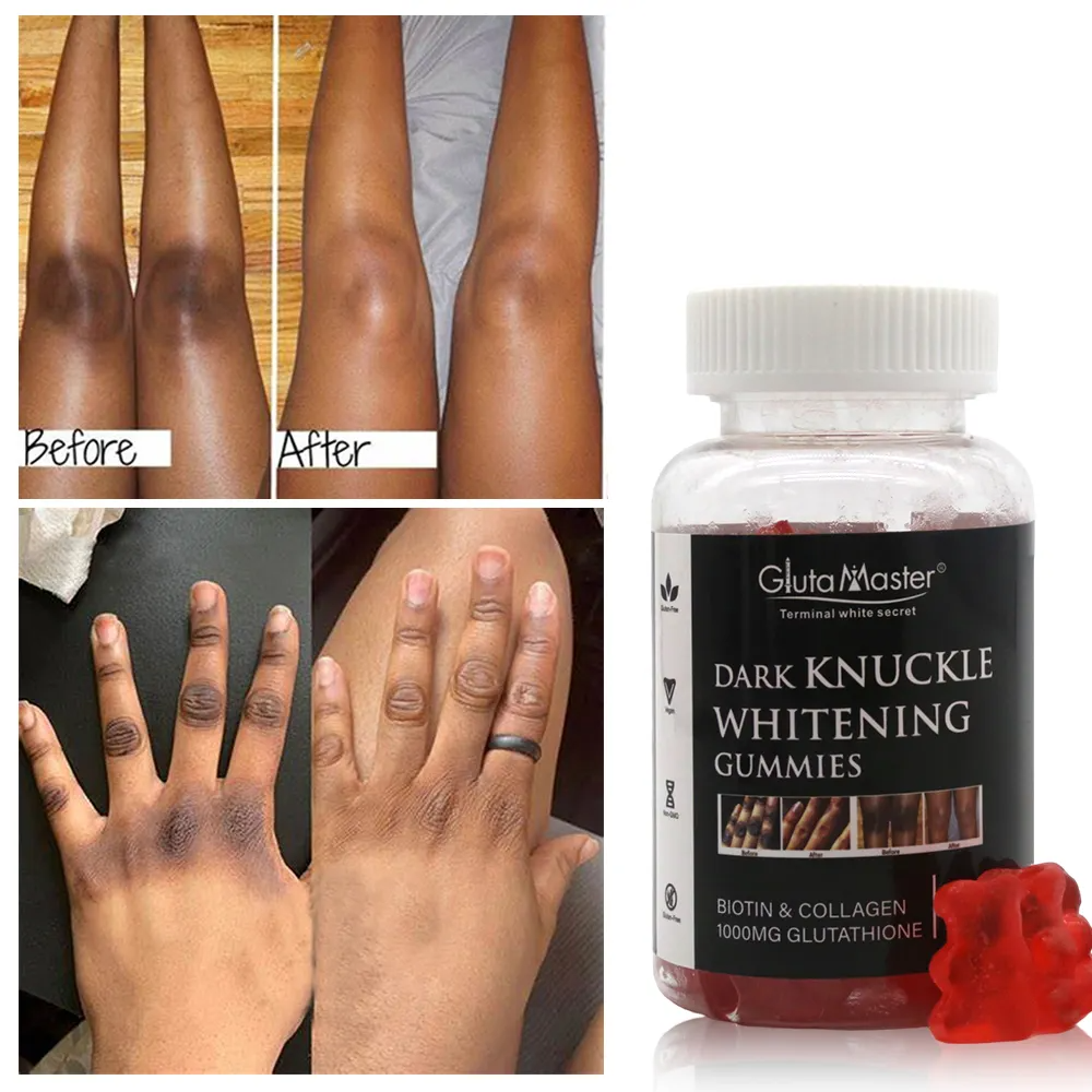 Gluta Master Dark Knuckle Whitening Gummies Targets Dark Knuckles, Promotes Even Skin Tone, Brightens Skin, Rich In Glutathione, Easy To Use