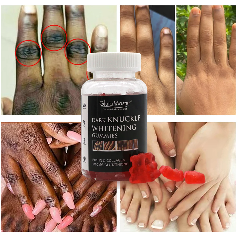 Gluta Master Dark Knuckle Whitening Gummies Targets Dark Knuckles, Promotes Even Skin Tone, Brightens Skin, Rich In Glutathione, Easy To Use