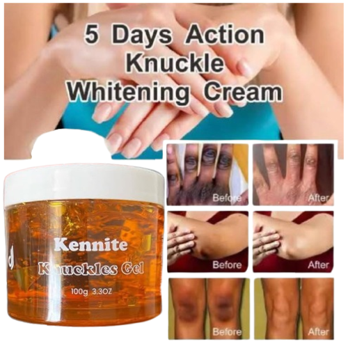 Kennite Knuckles Gel Fast Action Cream For Whitening Dark Knuckles, Elbows, Knees & Spots – Visible Results In 5 DaysPowerful Brightening Gel That Fades Dark Knuckles, Evens Skin Tone