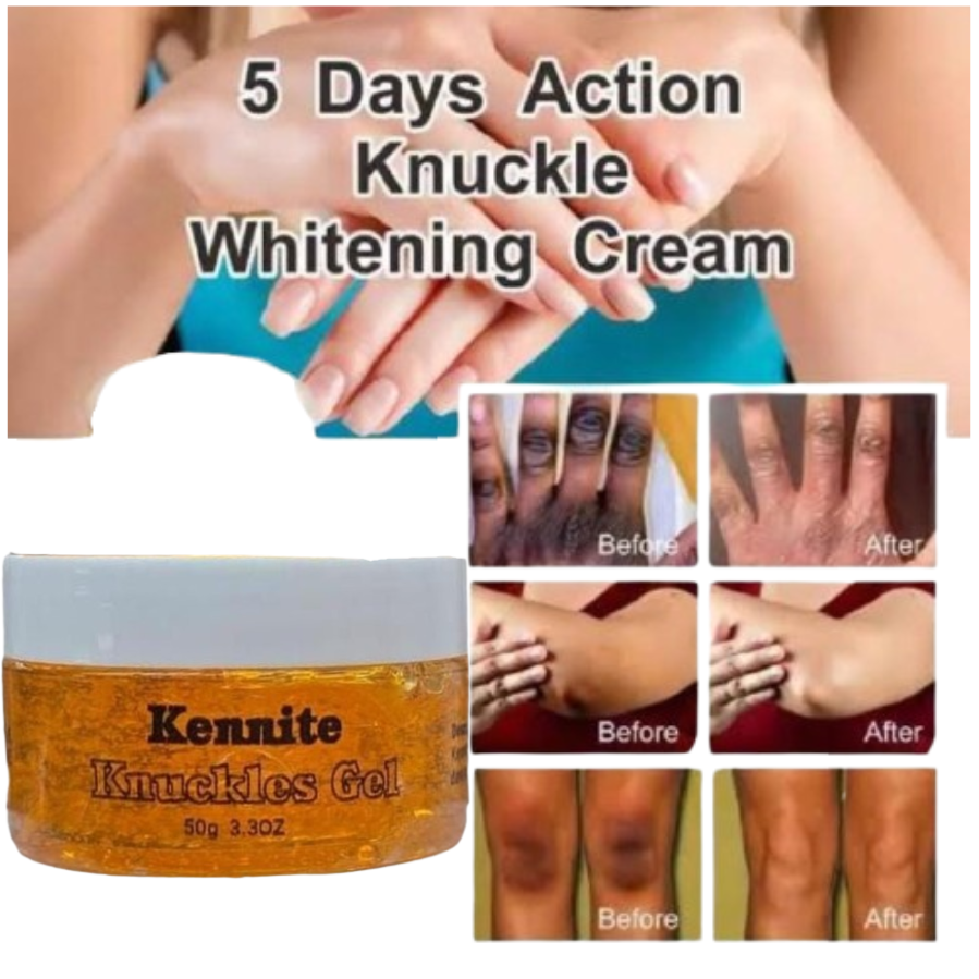 Kennite Knuckles Gel Fast Action Cream For Whitening Dark Knuckles, Elbows, Knees & Spots – Visible Results In 5 DaysPowerful Brightening Gel That Fades Dark Knuckles, Evens Skin Tone