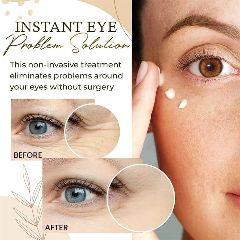 Bioaqua Rice Raw Pulp Eye Cream - Eye Cream for Dark Circles and Puffiness, Eye Cream Anti Aging, Aging Lifting Eyes Serum Cream for Women & Men 20g