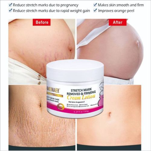 DR MEINAIER Stretch Mark Removed & Skin Firming Cream Anti Stretch Marks 150g