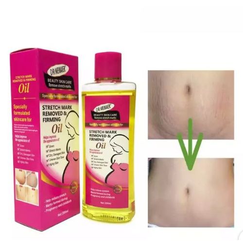 DR MEINAIER Stretch Mark Remover Oil Skin Firming Clears Stretch Marks 200 ml