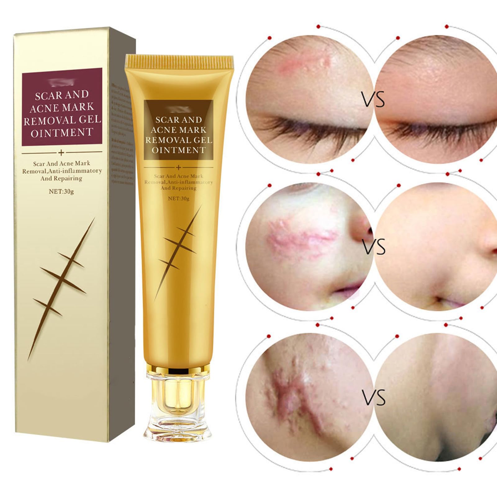 Scar Repairing Gel Cleaning Soothing Nourishing Scars Burns Cuts Gel for Damaged Skin 30g