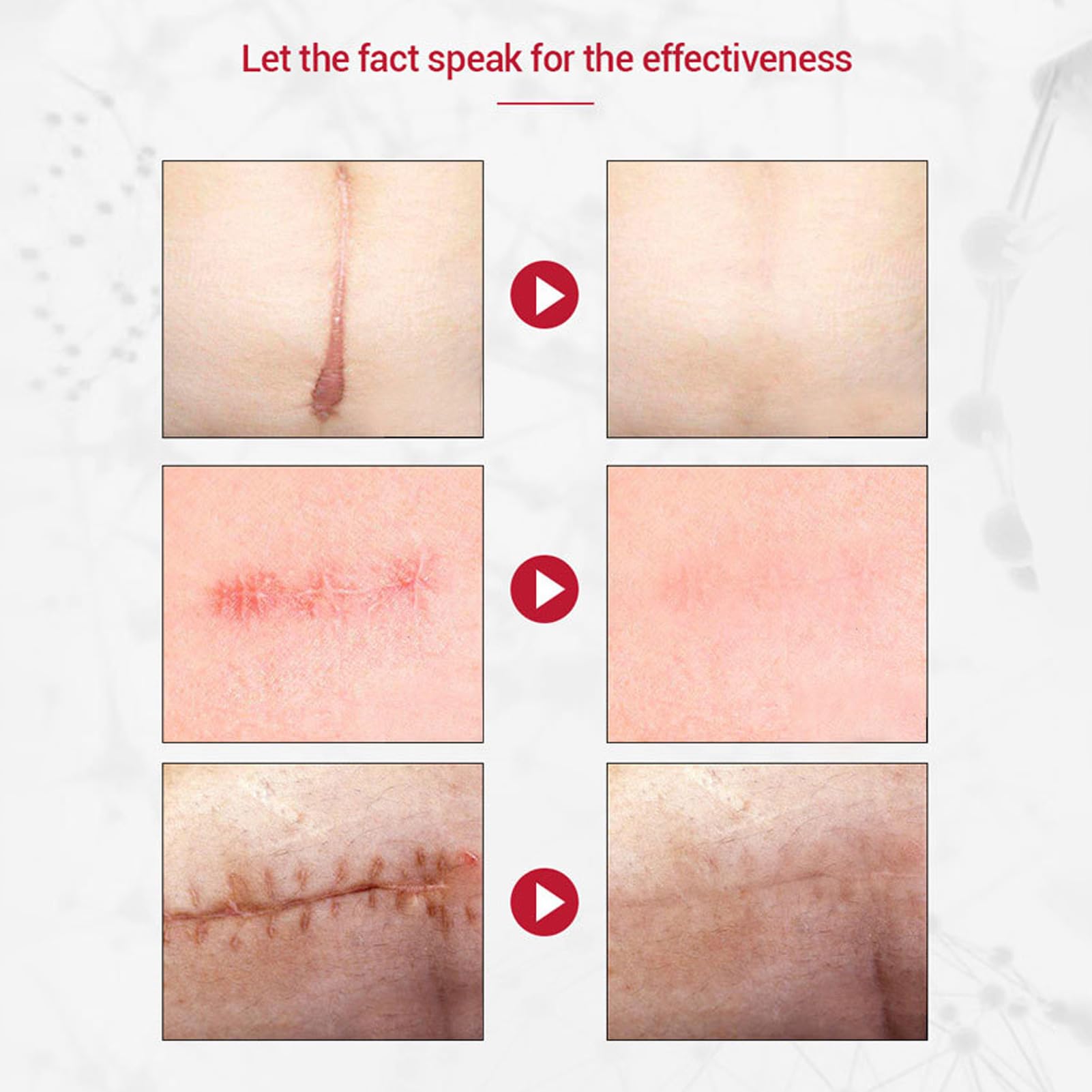 Scar Repairing Gel Cleaning Soothing Nourishing Scars Burns Cuts Gel for Damaged Skin 30g