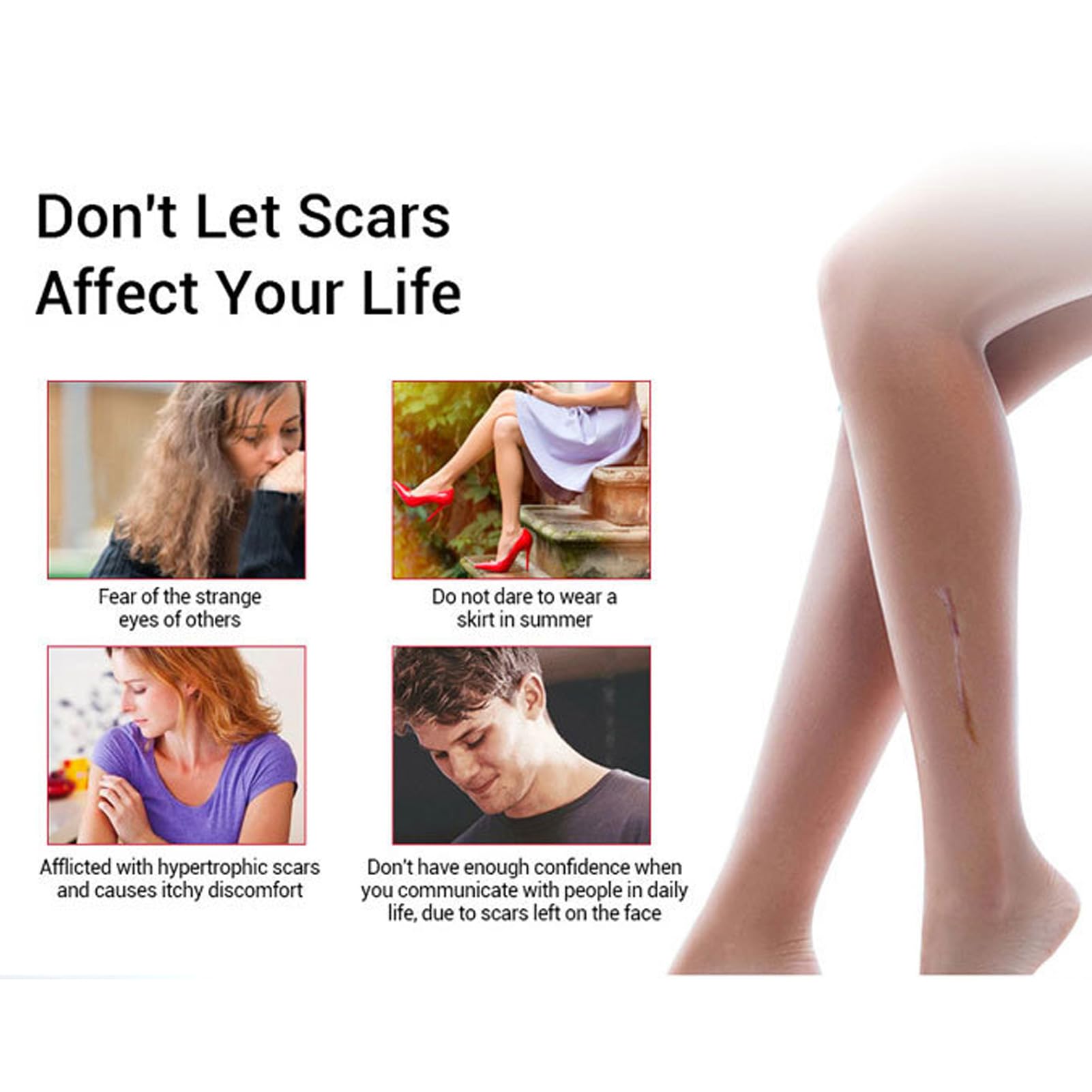 Scar Repairing Gel Cleaning Soothing Nourishing Scars Burns Cuts Gel for Damaged Skin 30g