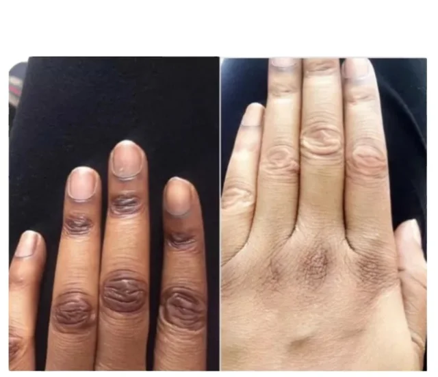 Extra Strong Peeling Oil 110 ml