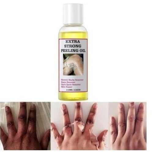 Extra Strong Peeling Oil 110 ml