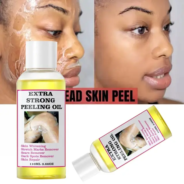 Extra Strong Peeling Oil 110 ml