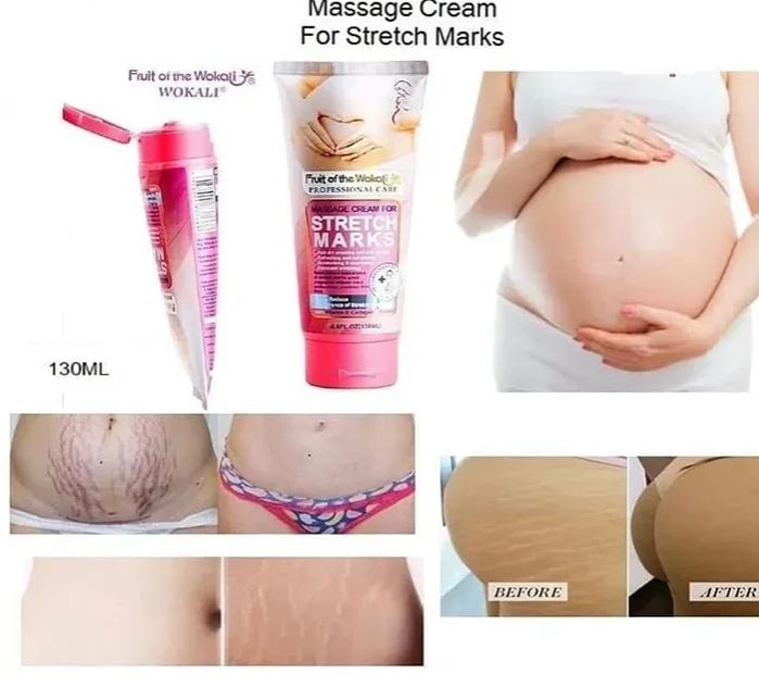 Fruit Of The Wokali Stretch Marks Remover Cream -130ML