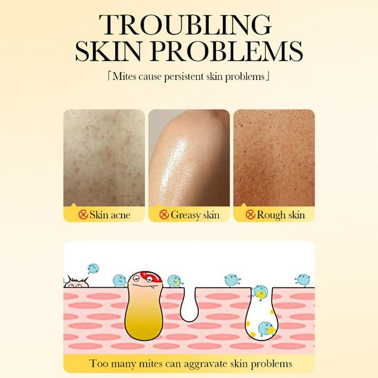 Sadoer Sulfur Cleaning Repair Multi-Action 3 In 1 Acne Soap 125g