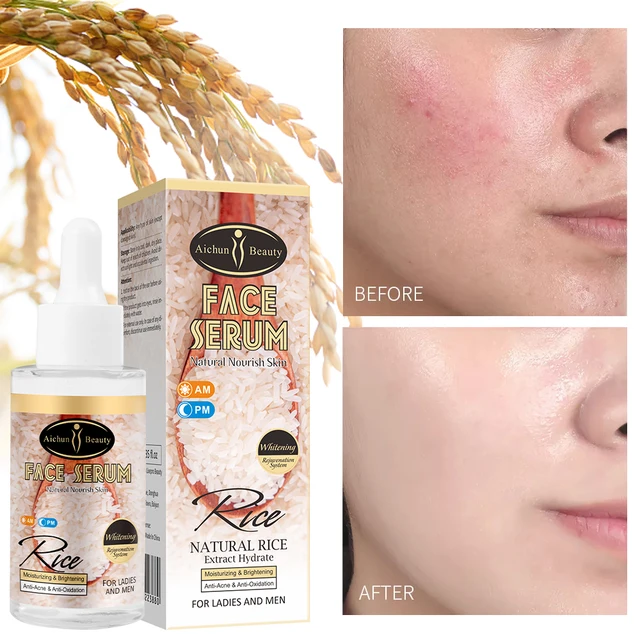 Aichun Beauty Moisturizing Brightening Facial Natural Rice Face Serum