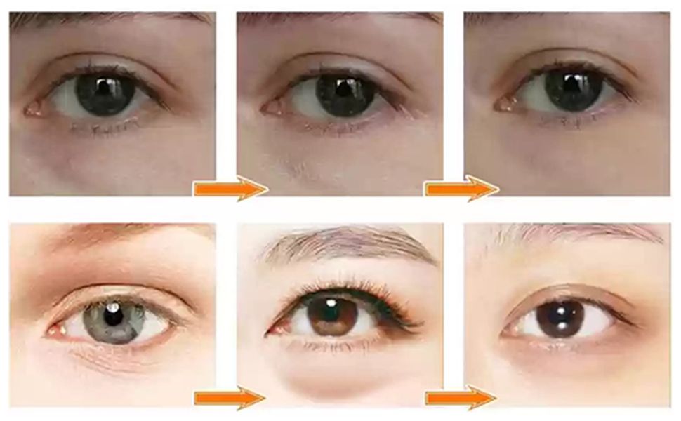 GuanJing Retinol Anti Aging Eye Cream Anti-Wrinkles Bags Dark Circles Removal Retinol Eye Cream For Women - 30g