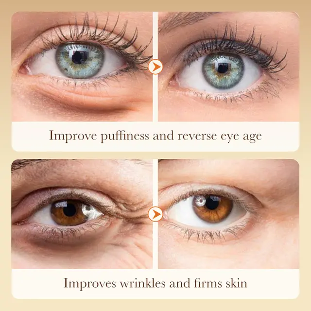 Sadoer Turmeric Firming Eye Cream for Dark Circles and Puffy Eyes 20g