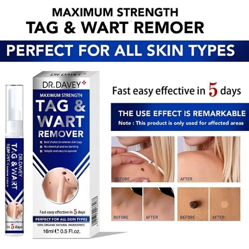 dr davey NEW ADVANCED MAXIMUM STRENGTH TAG & WART REMOVER 16ML