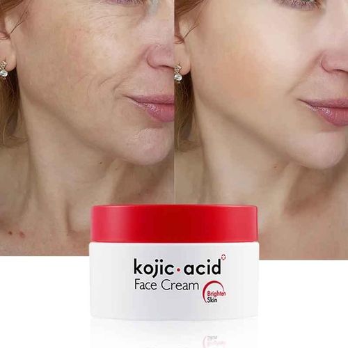 Kojic Acid Anti- Wrinkle Collagen Face Cream Face Moisturizer