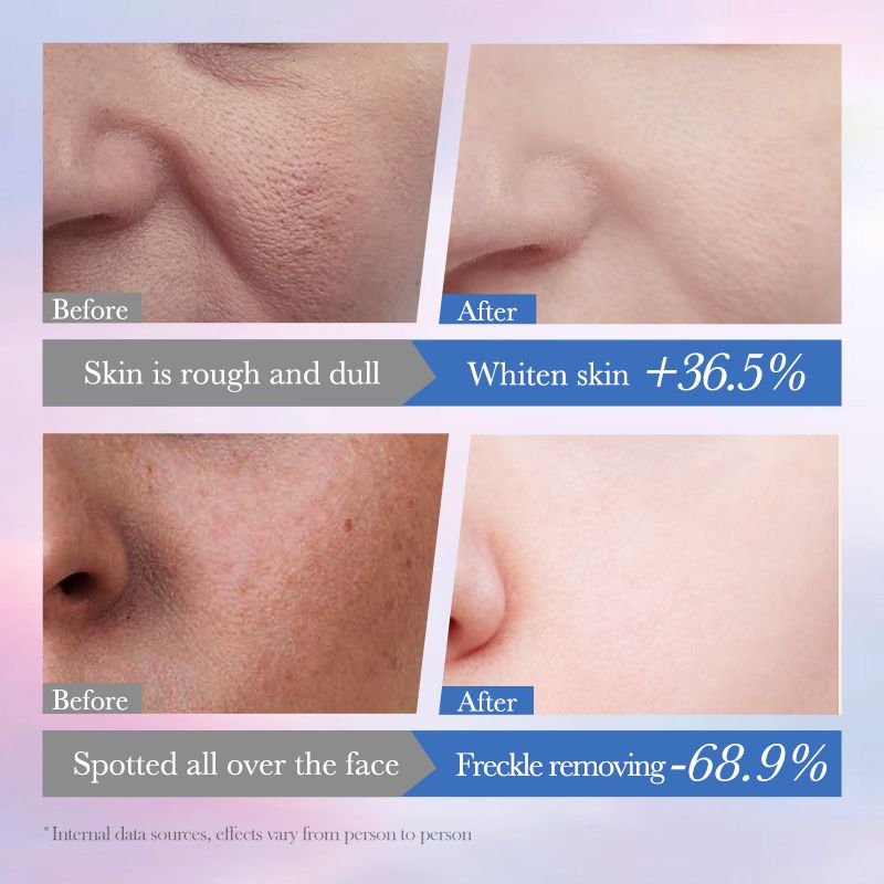 Sadoer Niacinamide Repair Serum Spot Removal with Tranexamic Acid Centella Alpha Arbutin, Ceramide Deep Whitenening, Brightening Nourish, Reduce Pigmentation, Soothing Hydrating Face Inhibits Melanin