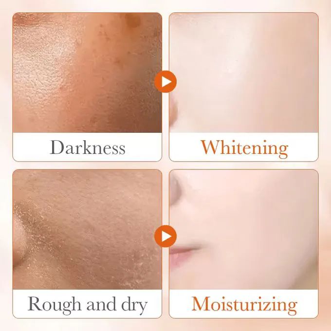 2 in 1 SADOER Skin Active 5 x Vitamin C Serum + Complementary 5x Vitamin C Cream, For Deep Hydration, Whitening Dark Spots, Moisturizing, Skin Tone Brightening and Skin Nourishment + Niacinamide