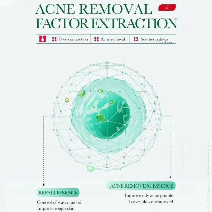 Bioaqua Acne Treatment Salicylic Acid Pimple remover Anti acne Shrink Pores Whitening facial mask acne cream Beauty and skin care health Face