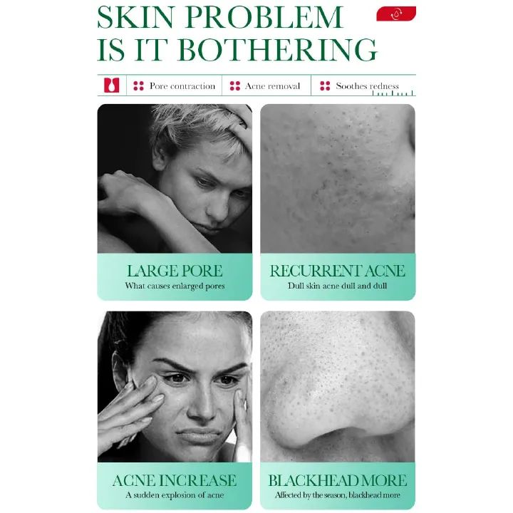 Bioaqua Acne Treatment Salicylic Acid Pimple remover Anti acne Shrink Pores Whitening facial mask acne cream Beauty and skin care health Face