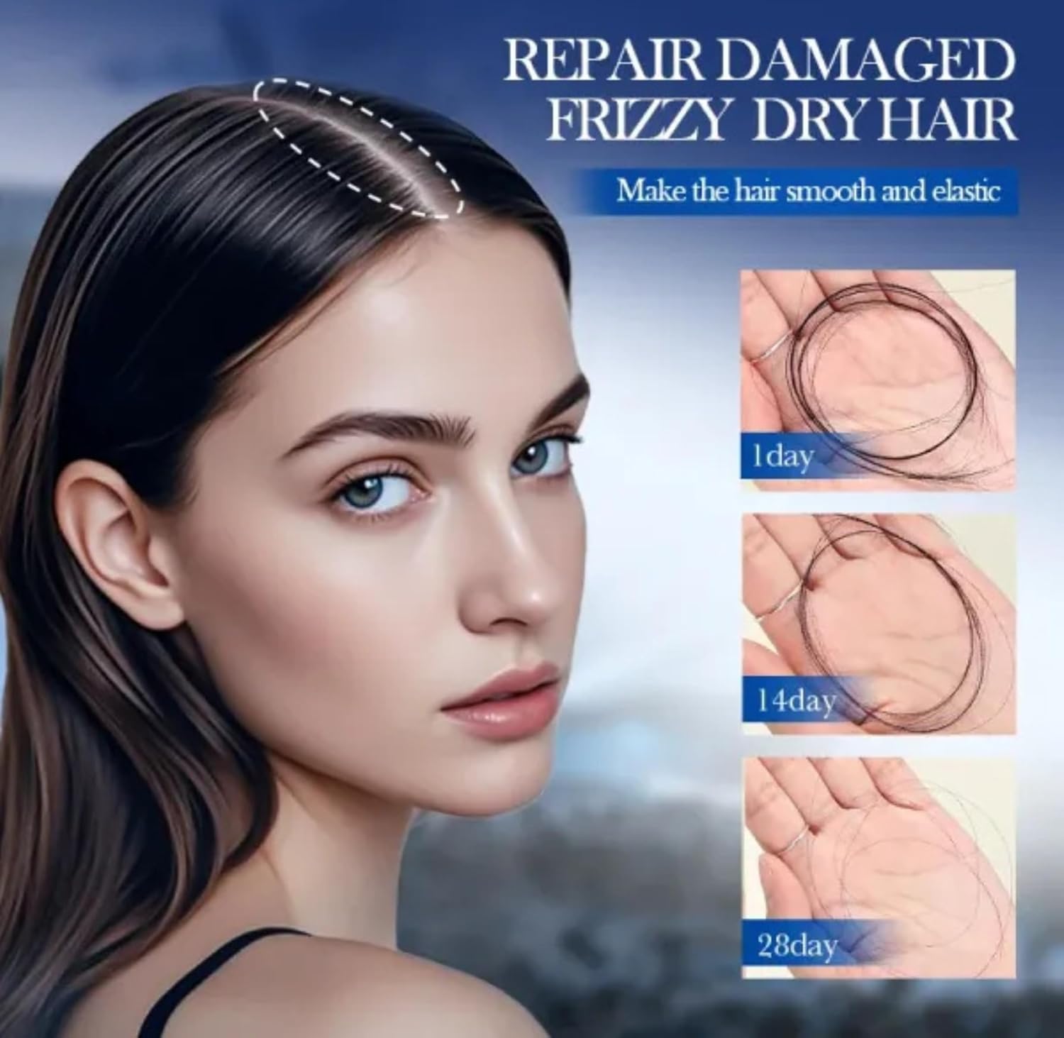 SADOER Minoxidil Biotin Hair Growth Shampoo, 5% Anti Hair Loss Treatment, Men Women Deep Cleansing Formula, 300ml