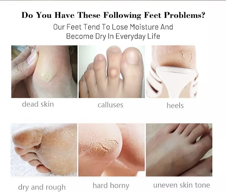 GuanJing Foot Skin Care Foot Mask Socks Peeling Remove Dead Skin Cells Moisturizing Exfoliating Foot Mask Exfoliating Gel Moisturizing For Women and Men 1 Pair