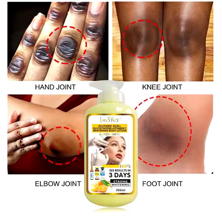 LANSYADE Wholesale Moisturiziing Vitamin C Body Lotion Strong Whitening Body Lotion 500ml Skin Revitalizer, Moisturizer, Whitening, Nourishing, Lightening