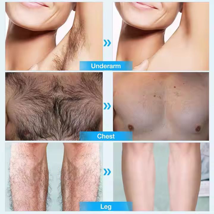 Disaar Permanent Hair Removal Spray Smooth & Painless Remove Hair Spray Foam For Men And Women Spray Removal Spray Face Arm Armpit Chest Back and Legs Skincare Hair Removal Cream