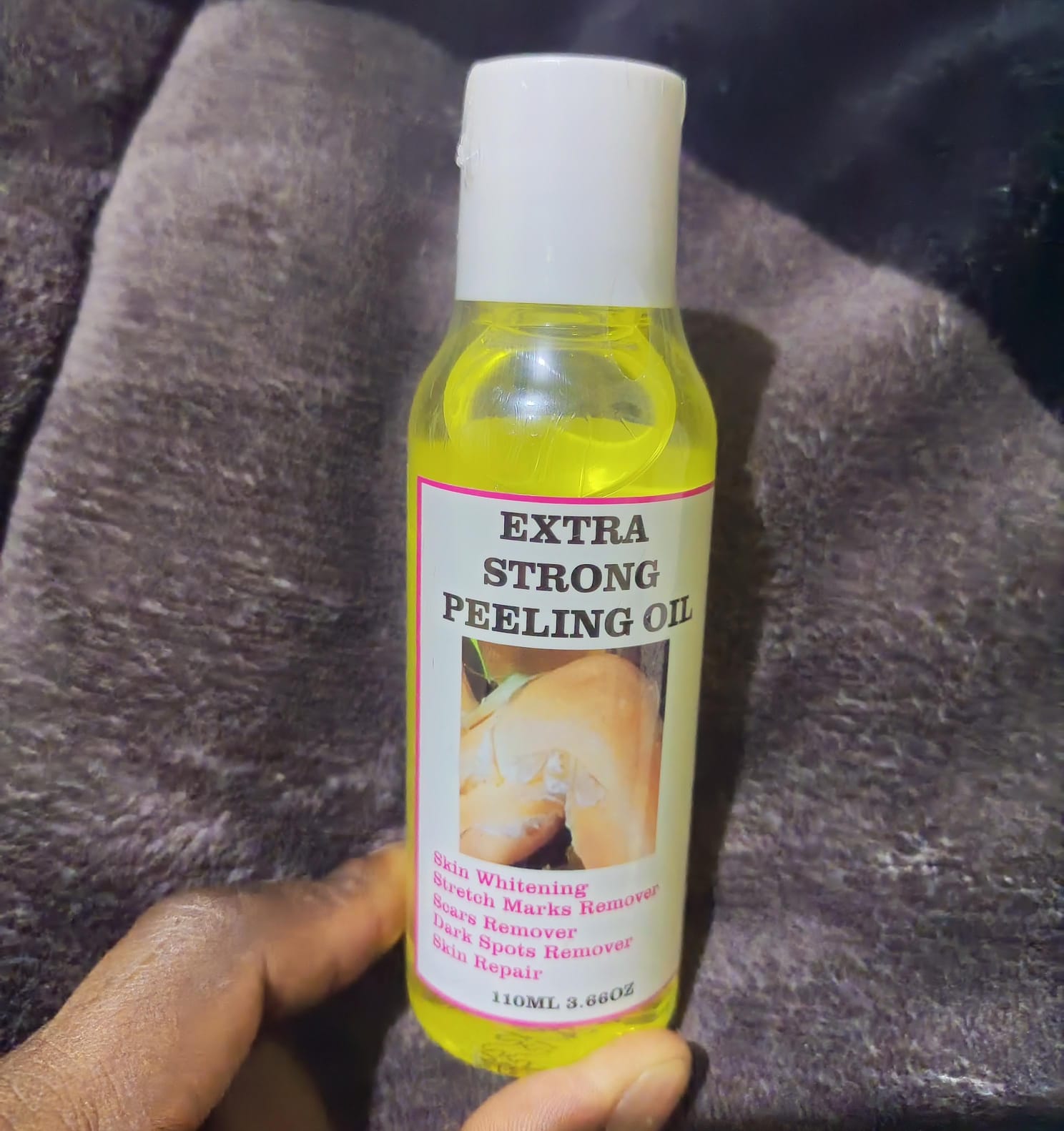 Peeling oil Extra Strong Yellow Peeling Oil skin whitening scars remover,stretch marks remover,dark spots remover,skin repair oil 110ml