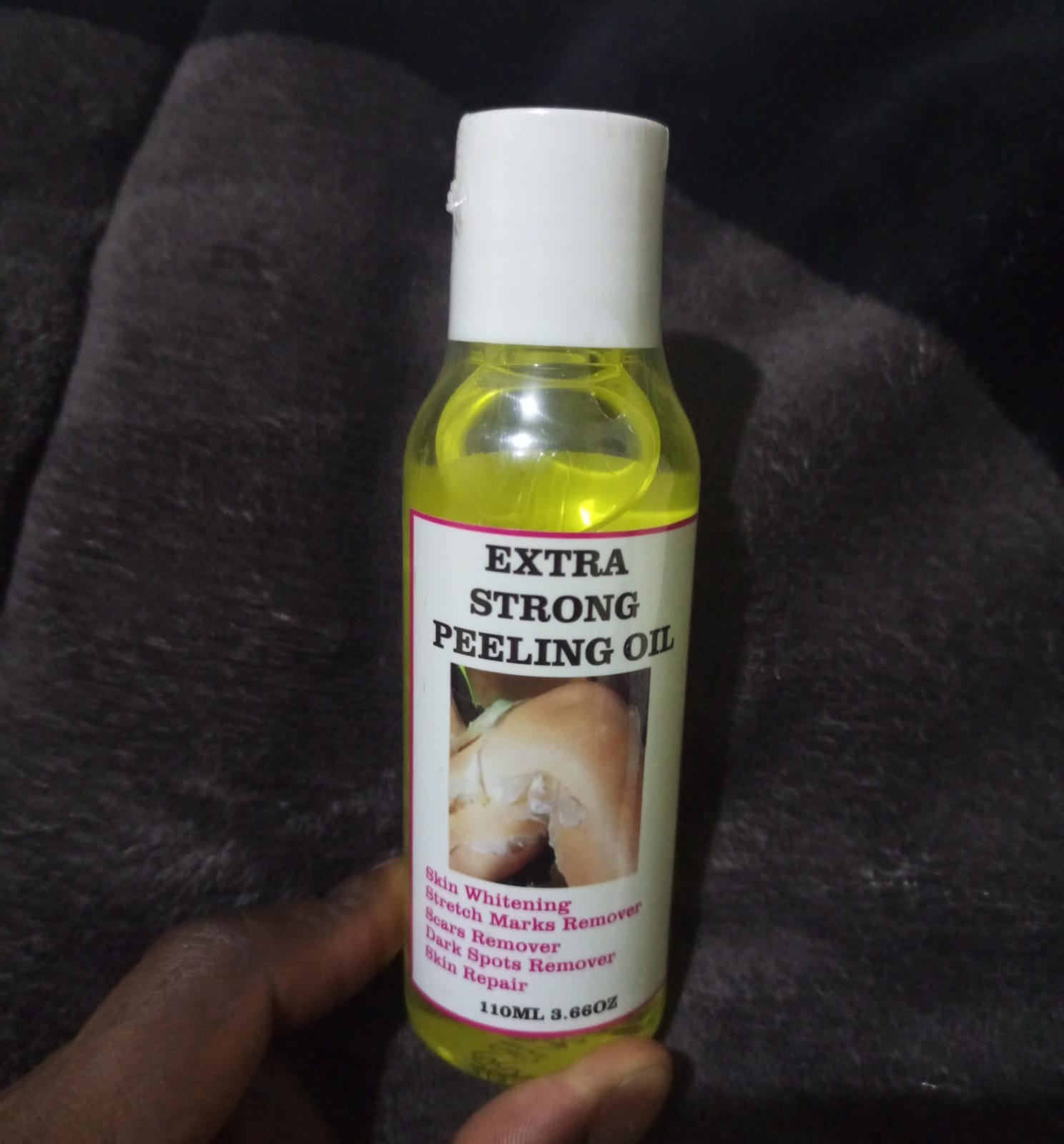 Peeling oil Extra Strong Yellow Peeling Oil skin whitening scars remover,stretch marks remover,dark spots remover,skin repair oil 110ml