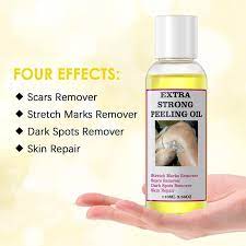 Extra Strong Peeling Oil Elbows Knees Hands Even Complexion