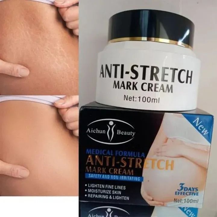 AICHUN BEAUTY Anti-Stretch Mark Cream Skin Firming Clears Stretch Marks